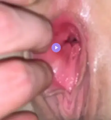 pussy pic